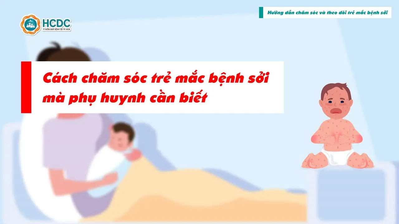 Hướng dẫn cách chăm sóc trẻ mắc bệnh sởi mà Phụ Huynh cần biết